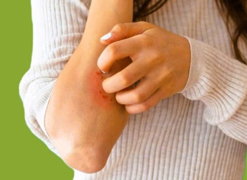 Skin Problems Skin Problems